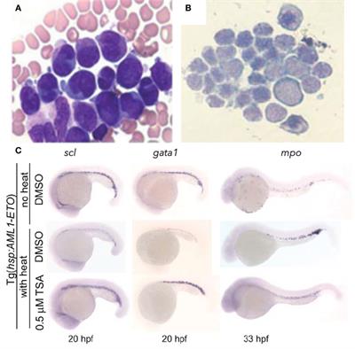 Modeling Myeloid Malignancies Using Zebrafish